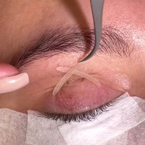 Eyelid Lifting Tape
